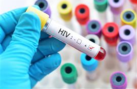 HIV diagnoses at all-time high in Eastern Europe